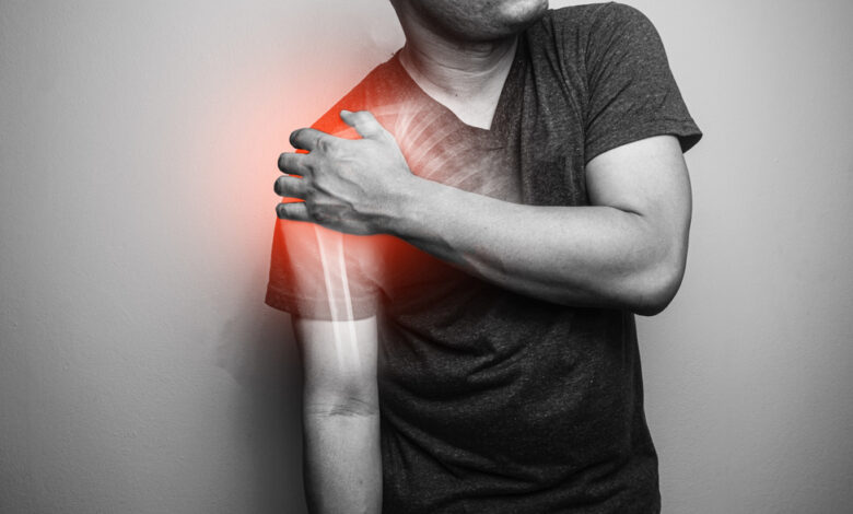 Shoulder Arthritis: Types, Symptoms & Treatment